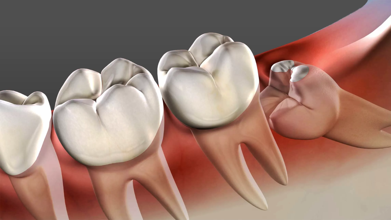 Are Teeth Bones?